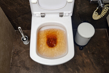 The housework was made easier by using a cleaning service for the dirty toilet and clogged drain.