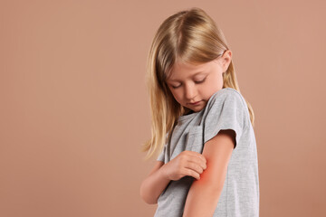 Suffering from allergy. Little girl scratching her arm on light brown background, space for text