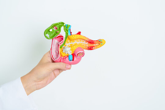 Doctor with human Pancreatitis anatomy model with Pancreas, Gallbladder, Bile Duct, Duodenum, Small intestine. Pancreatic cancer, Acute and Chronic pancreatitis,  Digestive system and Health concept