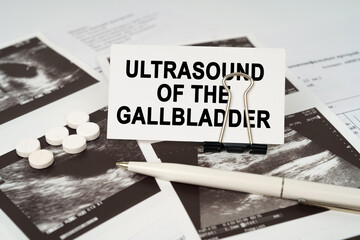 On the ultrasound pictures there is a pen and a business card with the inscription - Ultrasound of the gallbladder - obrazy, fototapety, plakaty
