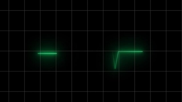 Green digital heartbeat monitor with pulse line animated on a dark grid background.