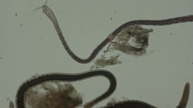 Naidid Worms
