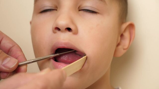 The doctor examines the oral cavity of a child with a missing tooth using a dental mirror and a wooden spatula. Healthcare and dental care concept.