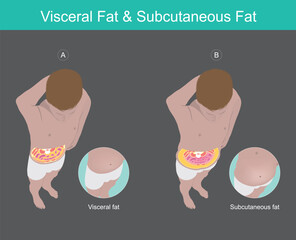Visceral Fat & Subcutaneous Fat Illustration. Illustration knowledge of the abdomen visceral fat in human.