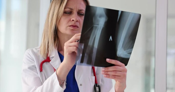 Woman traumatologist looking at xray with broken arm 4k movie slow motion