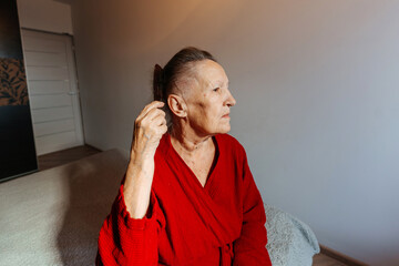 balding grandmother from chemotherapy with a comb. hair loss in a woman due to a cancerous tumor. a...