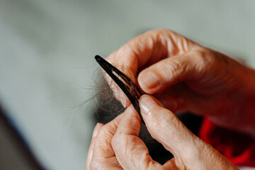 a woman's hair fell out due to cancer. the hair on the barrette is due to chemotherapy. scraps of...
