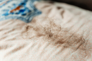 the fallen hair of a woman from a cancerous tumor on a pillow. hair falling out on the bed from...