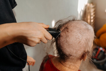 shaving woman because of a cancerous tumor. removal of hair on the head with an electric razor...