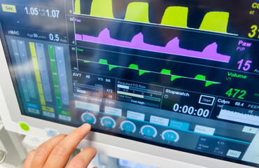 Hospital monitor displays vital signs, healthcare concept, medical equipment, patient health tracking