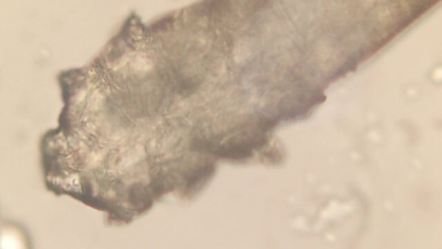 high resolution footage of face mite demodex under the microscope