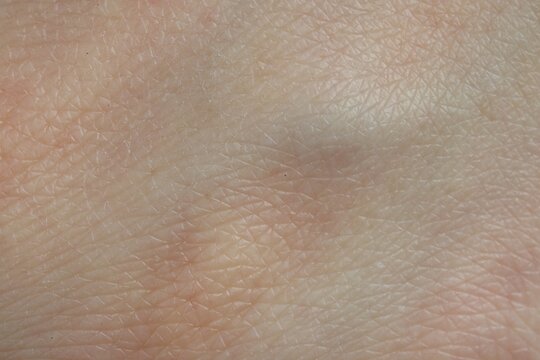 Texture of healthy skin as background, macro view