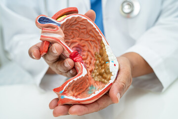 Stomach disease, doctor with anatomy model for study diagnosis and treatment in hospital.