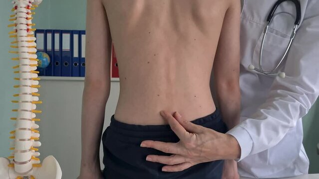 Orthopedist examines spine and posture and spinal deformities of teenage patient. Teenage boy visits pediatrician for annual checkup