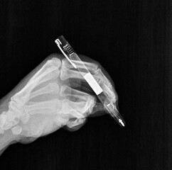 film xray x-ray or radiograph of a human hand with a writing utensil or pen drawing, writing,...