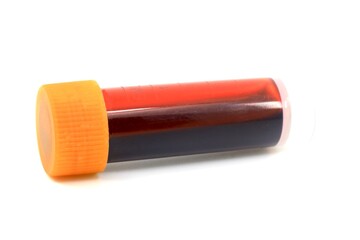 Blood sample for medical testing