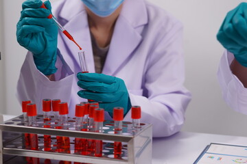 Hands of a doctor or female doctor collecting blood sample tubes from rack with analyzer in lab....