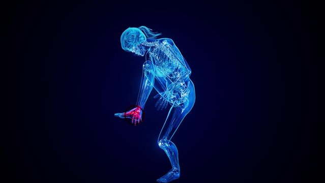 4K abstract animation of plantar fascitis