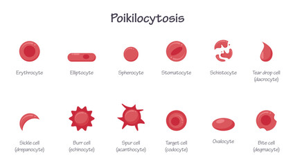 Poikilocytosis morphology of erythrocytes red blood cell RBC educational vector illustration graphic - obrazy, fototapety, plakaty