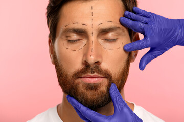 Doctor checking patient's face before cosmetic surgery operation on pink background, closeup - obrazy, fototapety, plakaty