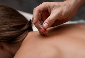 A masseuse performs acupuncture on a girl on a massage table