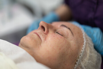 Large close-up on the face of an elderly woman who is lying down.