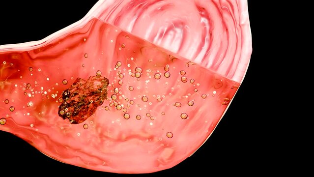 Human Stomach Anatomy Digestion, esophagus abdomen gastric with acid digestive, Cross cut section isolated of internal organ, Gastric gut, process of break down the food, nutrition concept, 3D reander