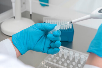 Doctor holding blood tube test in the research laboratory.Corona virus pandemic concept.Coronavirus vaccine development