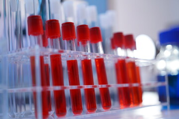 Science test tubes, laboratory equipment for new medical research, microbiology research with small pipettes in close-up. Asian and African female scientists in the laboratory, perfume samples