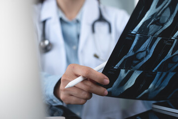 Orthopedics surgeon doctor examining patient's knee joint x-ray films, MRI bone, ct scan in at...