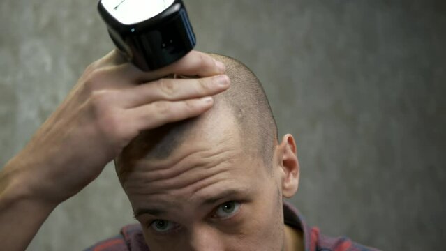 Close-up of the head of a bald man who shaves his bald head with an electric razor. a man who has lost his hair takes care of his hair and scalp. Middle-aged man with short hair cuts his own hair.