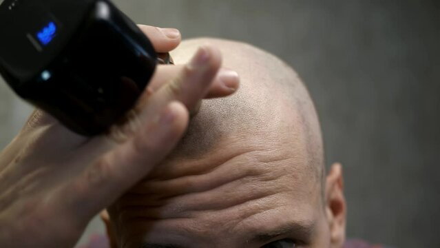 Close-up of the head of a bald man who shaves his bald head with an electric razor. a man who has lost his hair takes care of his hair and scalp. Middle-aged man with short hair cuts his own hair.