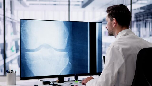 Doctor Screening Knee Bone X Ray