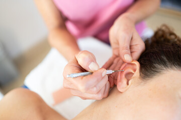 Obraz na płótnie Canvas Auriculotherapy treatment on female ear with flexible massage brass ear pen