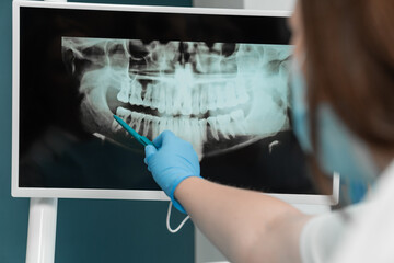 The dentist indicates a panoramic X-ray on the monitor, highlighting all important aspects on it,...