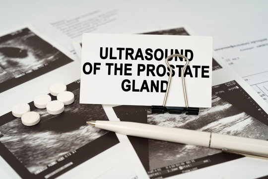 On the ultrasound pictures there is a pen and a business card with the inscription - Ultrasound of the prostate gland