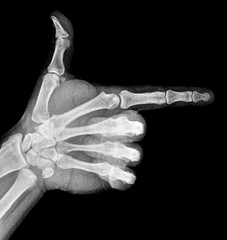 Obraz premium Film xray x-ray or radiograph of a thumb and finger in gestural language, manual communication, or signing aka sign language, pointing this way or that way to the right
