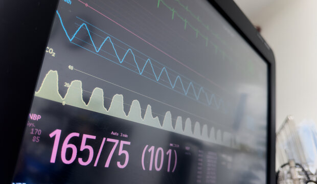 Hospital monitor displaying vital signs: heart rate, blood pressure, oxygen levels, crucial for patient health and medical assessment