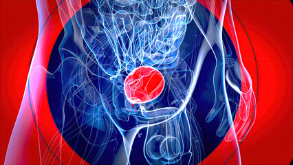 Abstract 3D illustration of the bladder cancer