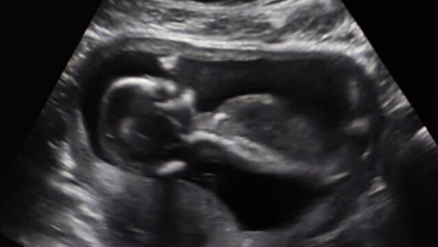 Ultrasound of baby . Human embryo moving on an ultrasound display. Baby in mother's womb during sonography