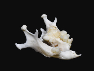 Neoplastic Bone Diseases