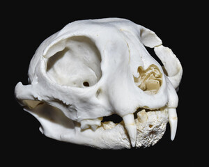 Neoplastic Bone Diseases