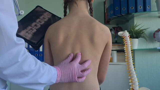 Pediatric surgeon looking at x-ray of child spine. Medic doctor points to x-ray of sick child
