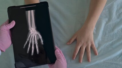 Doctor holding tablet with x-ray of child patient hand. Bruise of the hand, dislocation, fracture - Powered by Adobe