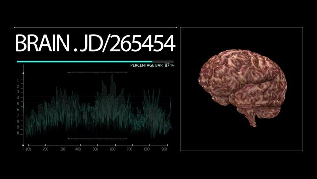 human brain scan loop video 