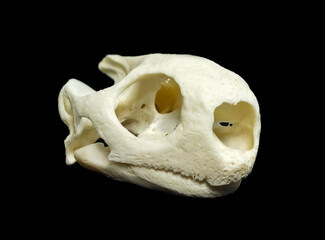 Periostitis, inflammation of the periosteum