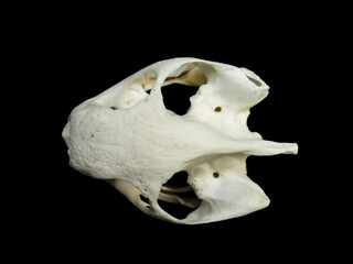 Periostitis, inflammation of the periosteum