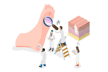 3D Isometric Flat  Conceptual Illustration of Foot Wart, Swollen Skin with Rough, Yellowing Patch © TarikVision