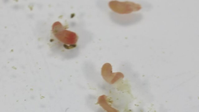 Study of Parasitic helminths (Trematodes) of marine fishes under a microscope.