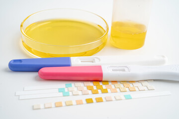 Urinalysis, pregnancy test and urine cup with reagent strip pH paper test in laboratory, contraception health and medicine.